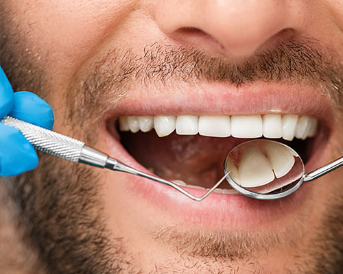 avatar-periodontal